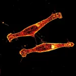 FAU discovery of tiny cell ‘tunnels’ finds new path to slow Huntington’s disease