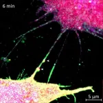 FAU discovery of tiny cell ‘tunnels’ finds new path to slow Huntington’s disease 2