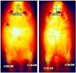 Fighting fat with fat: Stem cell discovery identifies potential obesity treatment