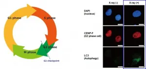 Finding the weak points in radiation-resistant pancreatic cancer cells