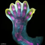 First map of human limb development reveals unexpected growth processes and explains syndromes found at birth 2