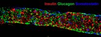 First stem cell-based approach to treat type 2 diabetes effective in mice