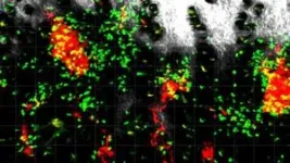 First therapeutic target for preserving heart function in patients with pulmonary hypertension 2