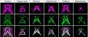 Fish reveal cause of altered human facial development 2