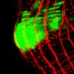 Flies with colon cancer help to unravel the genetic keys to disease in humans