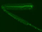 Fly model of motor neuron degeneration provides new avenues for exploration in humans