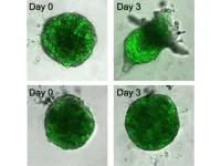 Follow the leader: Researchers identify mechanism of cancer invasion