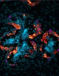 Following the ‘BATT Signal:’ A new signaling pathway controlling planarian germ cells