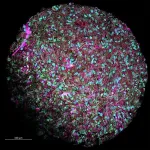 Forgoing one food treats eosinophilic esophagitis as well as excluding six 2