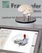 Fraunhofer MEVIS: New procedure to make brain surgery safer