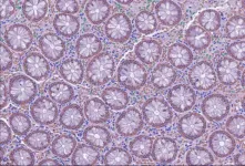 From pathology image to biological discovery: A journey with LazySlide