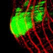 Fruit flies reveal features of human intestinal cancer 3