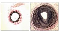 G proteins regulate remodelling of blood vessels 