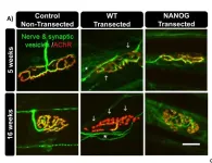 Gene named for mythical Irish land could aid muscle function after traumatic nerve injuries