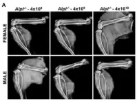 Gene therapy may be “one shot stop” for rare bone disease 2