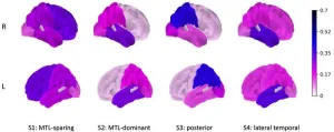 Genomics- and image-guided subtyping refines characterization of Alzheimer’s disease