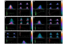 Geraniol attenuates oxidative stress and cognitive impairment in mouse aging model