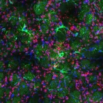 Glial cells help mitigate neurological damage in Huntingtons disease