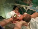 Guidelines developed for extremely premature infants at NCH proven to be life-changing