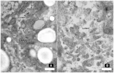 Harnessing nature to defend soybean roots