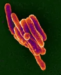 Harnessing power of immune system may lessen reliance on antibiotics for infections like TB 2