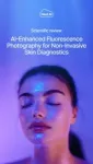 Haut.AI explores the potential of AI-enhanced fluorescence photography for non-invasive skin diagnostics 3