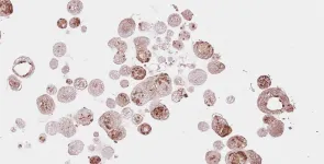 Head and neck cancer organoids as a step towards personalized treatments