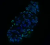 Head and neck cancer organoids as a step towards personalized treatments 2