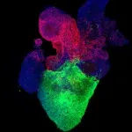 Heart organoids simulate pregestational diabetes-induced congenital heart disease 2
