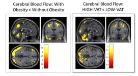 Hidden fat predicts Alzheimer’s 20 years ahead of symptoms