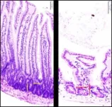 High-fat diets alter gut bacteria, boosting colorectal cancer risk in mice 3