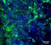 High heat dissipation design improves thermal protection on ultrahigh temperature ablation 3