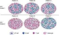 Histopathologic features and differential diagnosis in challenging cases of nodular lymphocyte predominant B-cell lymphoma/Nodular Lymphocyte Predominant Hodgkin Lymphoma