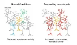 Holographic microscopy illuminates pain-driven changes in neuronal network activity