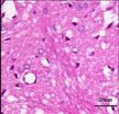 Houshiheisan maintains stabilization of the internal environment of neurovascular units