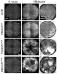 How a new blood-vessel-on-a-chip can help researchers further understand vascular malformations