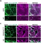 How a new blood-vessel-on-a-chip can help researchers further understand vascular malformations 2