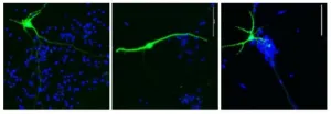 How air pollution and wildfire smoke may contribute to memory loss in Alzheimer’s disease