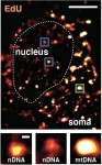 How brain cells repair their DNA reveals hot spots of aging and disease