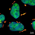 How DHX9 stress granules protect daughter cells from UV-induced RNA damage