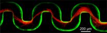 How do bacteria clog medical devices? Very quickly