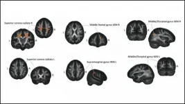 How learning Braille changes brain structure over time