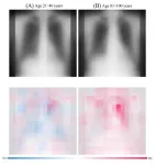 How old are you, really? AI can tell your true age by looking at your chest