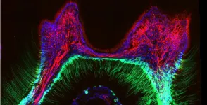 How teeth sense the cold