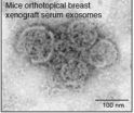 How the breast cancer cells transform normal cells into tumoral ones?