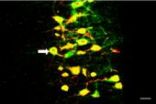 How to increase the survival rate of motor neurons after spinal root avulsion