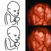 Human brains outpace chimp brains in the womb