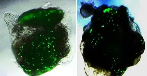 Human lung and brain organoids respond differently to SARS-CoV-2 infection in lab tests