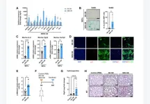 Human senescent fibroblasts cause lung fibrosis in mice