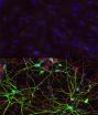 Human skin cells reprogrammed directly into brain cells 2